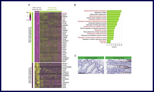 GUT 高分文章‖基因組測(cè)序 + 單細(xì)胞測(cè)序應(yīng)用于發(fā)病機(jī)制研究