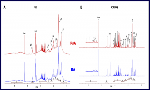 代謝組 | 利用代謝物和脂質類差異來鑒定 negRA 和 PsA 潛在生物標志物