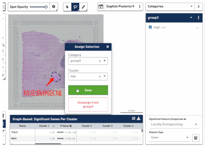 根據(jù)病理信息選取特定區(qū)域分析