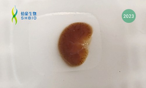 樣本指南 |FFPE 樣本空轉送樣指南