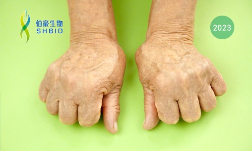 高分文獻(xiàn)一作分享會 | 時(shí)空組學(xué)技術(shù)助力發(fā)現(xiàn)類風(fēng)濕關(guān)節(jié)炎疾病治療新靶點(diǎn)