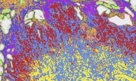 空間轉(zhuǎn)錄組測序平臺